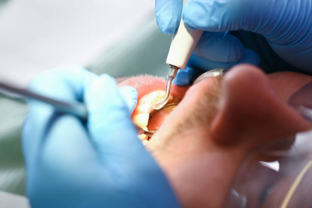 Best Dentist for Dental Trauma  in Canfield, OH